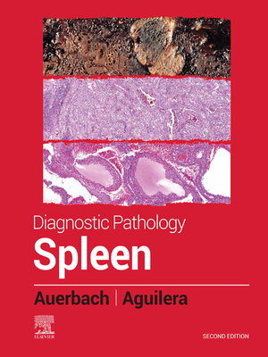 cover image of Spleen